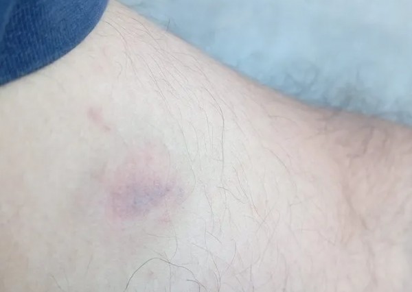 Adana’da yol isteyen adam saldırganların kurbanı oldu!